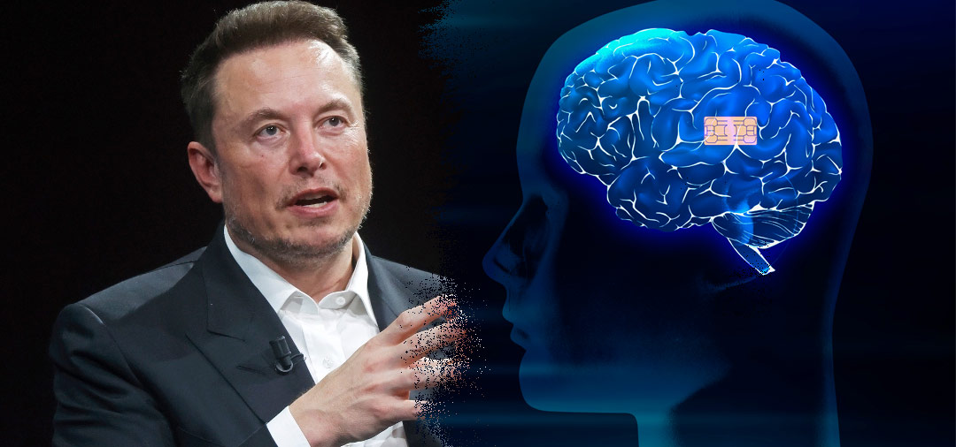 Empresa de Elon Musk implantó su primer chip cerebral